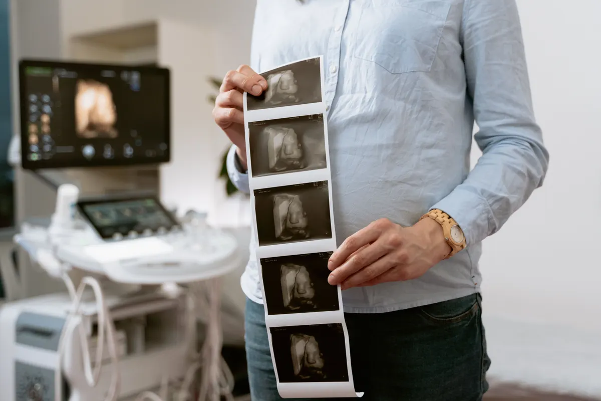 Future mère tenant ses clichés d'échographie dans un cabinet médical