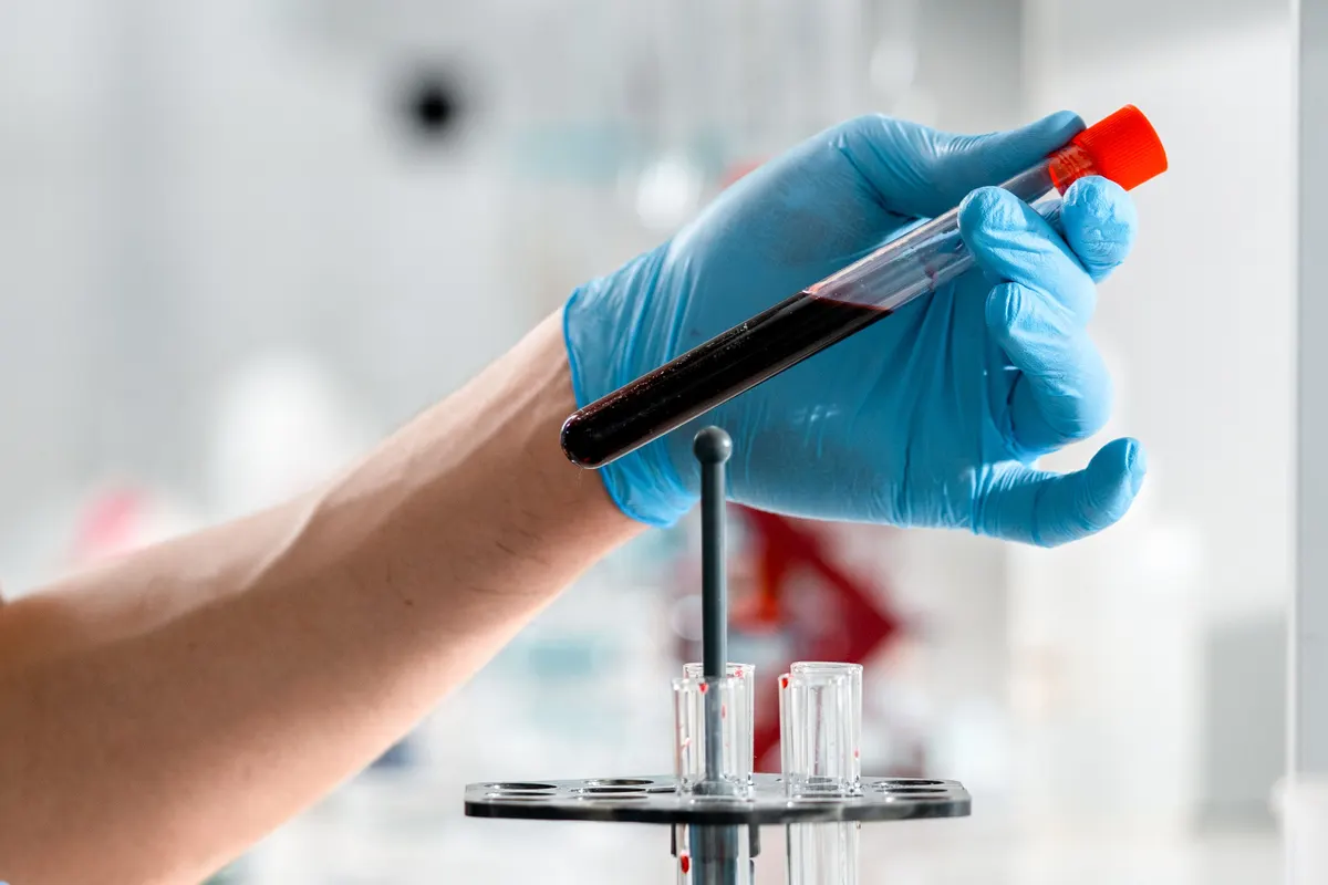 Technicien de laboratoire tenant un tube de prélèvement sanguin pour un dosage