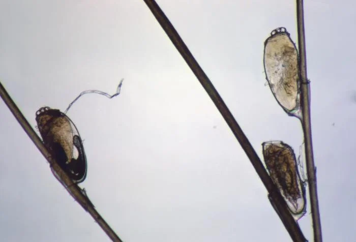 Trois lentes de poux collées à des cheveux, vues au microscope, à différents stades de développement